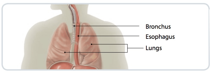 Lung